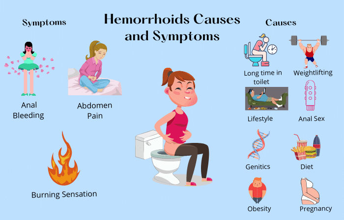 6 Causes of piles or hemorrhoids