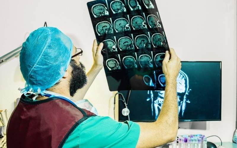 Best-Neurologists-in-Allahabad