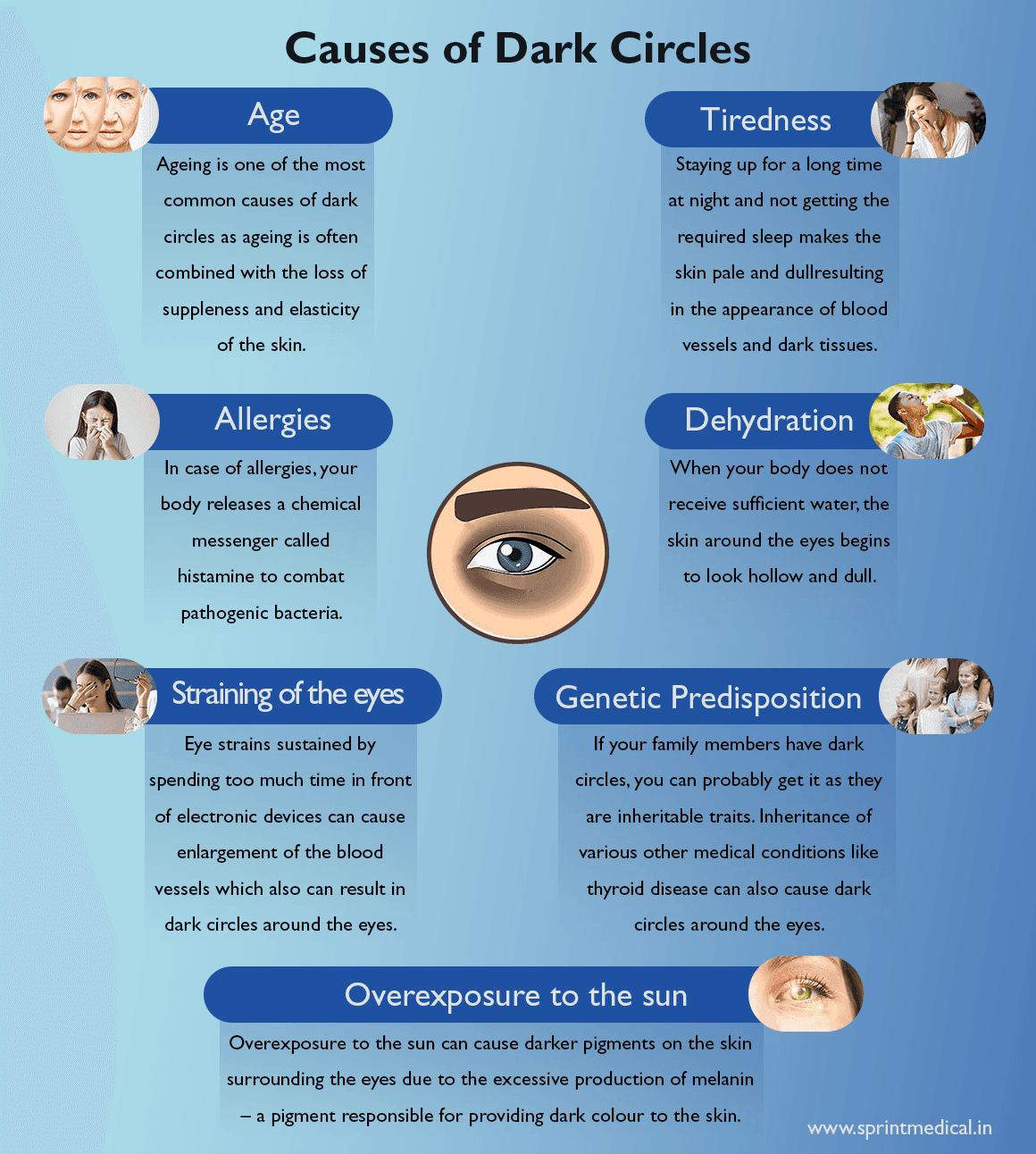 Causes of Dark Circles
