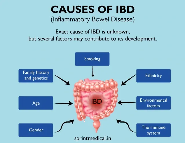 Causes of IBD (inflammatory bowel disease)