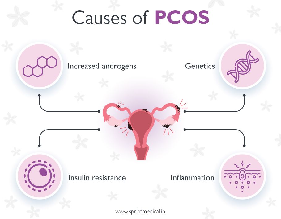Causes of PCOS