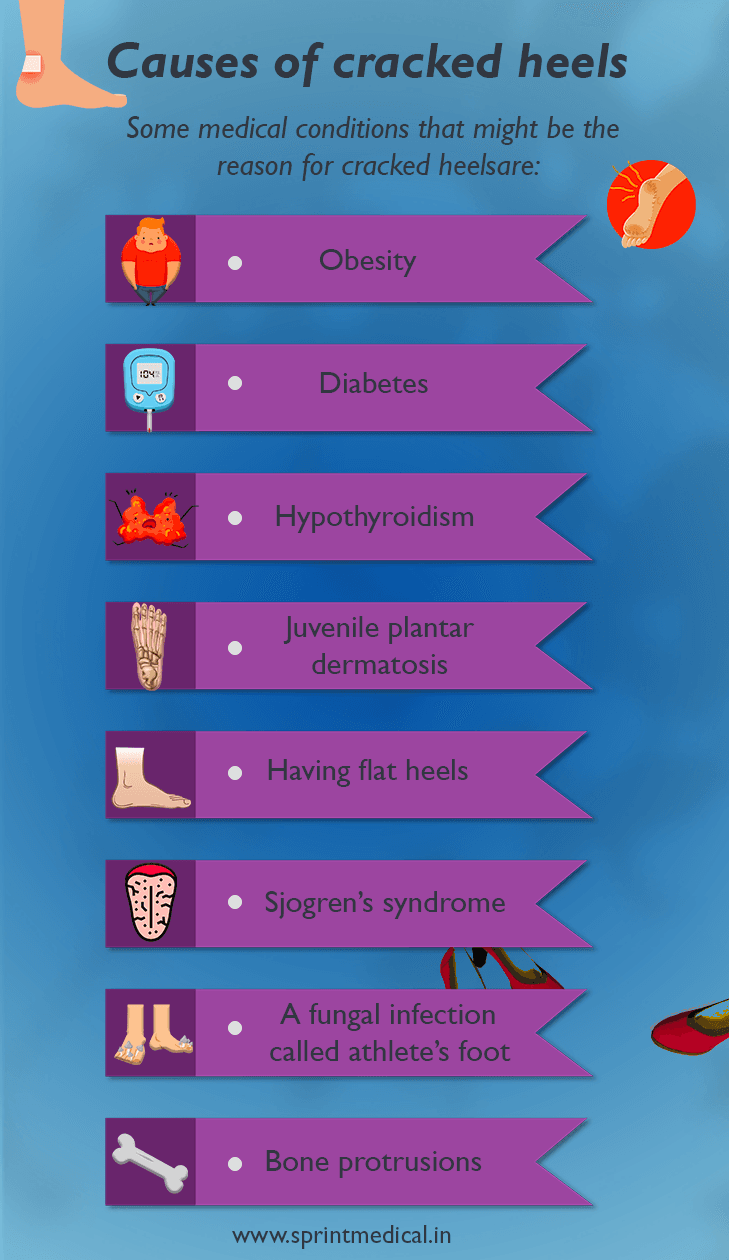Causes of cracked heels