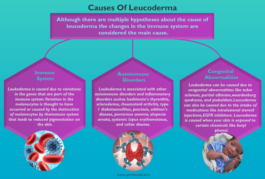 3 Main causes of leucoderma