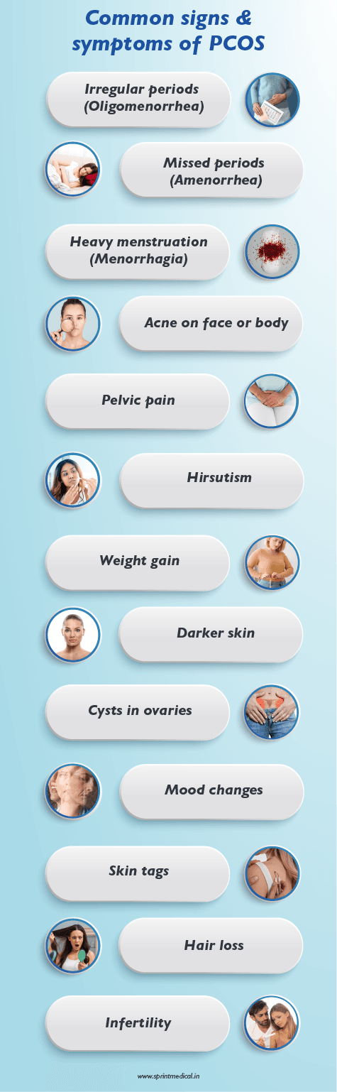 Common signs and symptoms of PCOS
