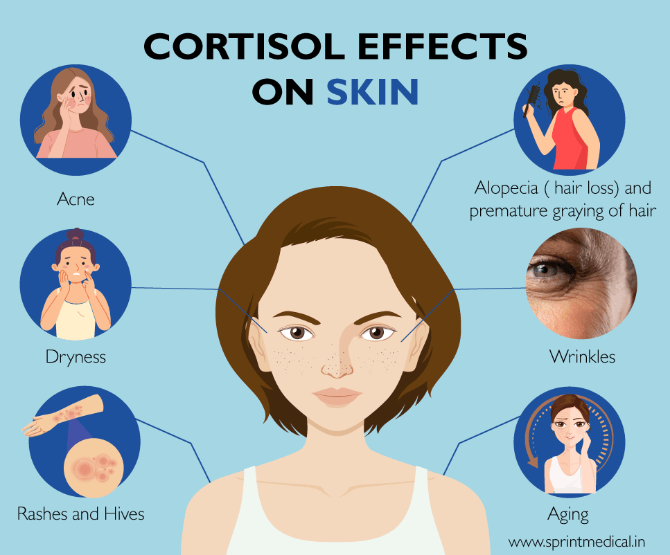 Cortisol effects on skin
