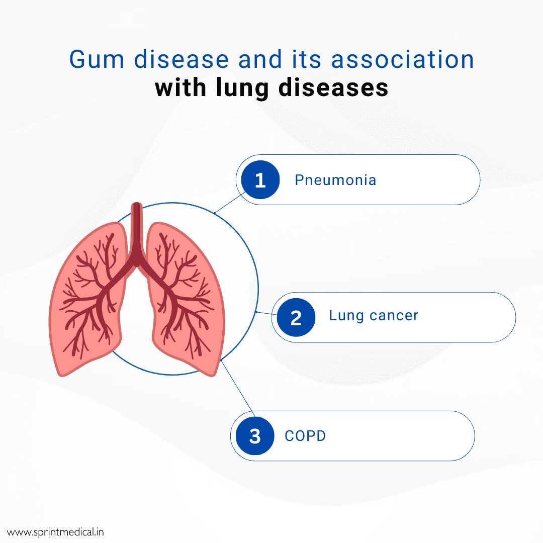 Gum disease and its association with lung diseases