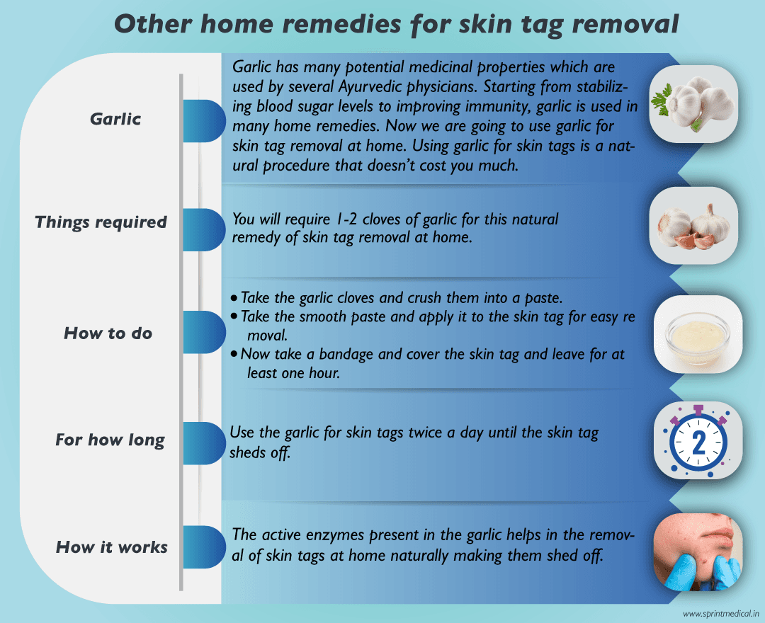 Home-remedies-for-skin-tag-removal-garlic