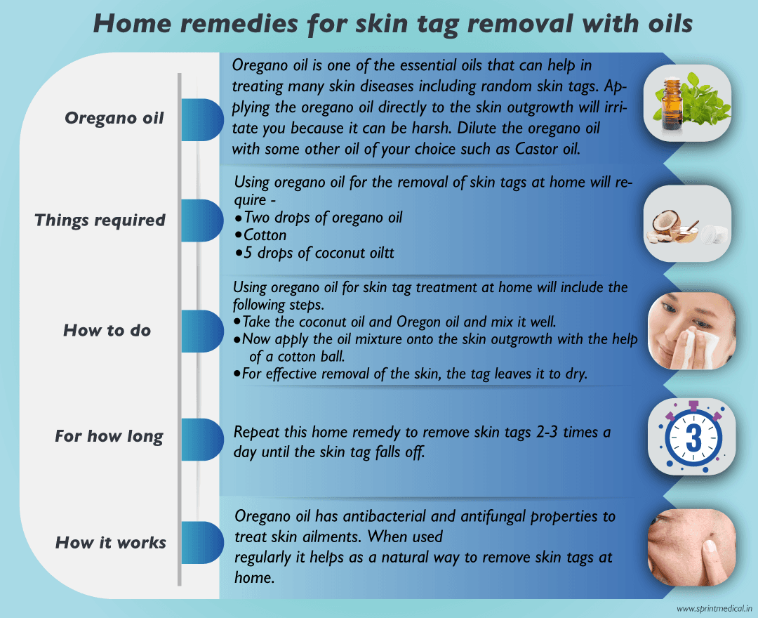 Home-remedies-for-skin-tag-removal-with-oregano