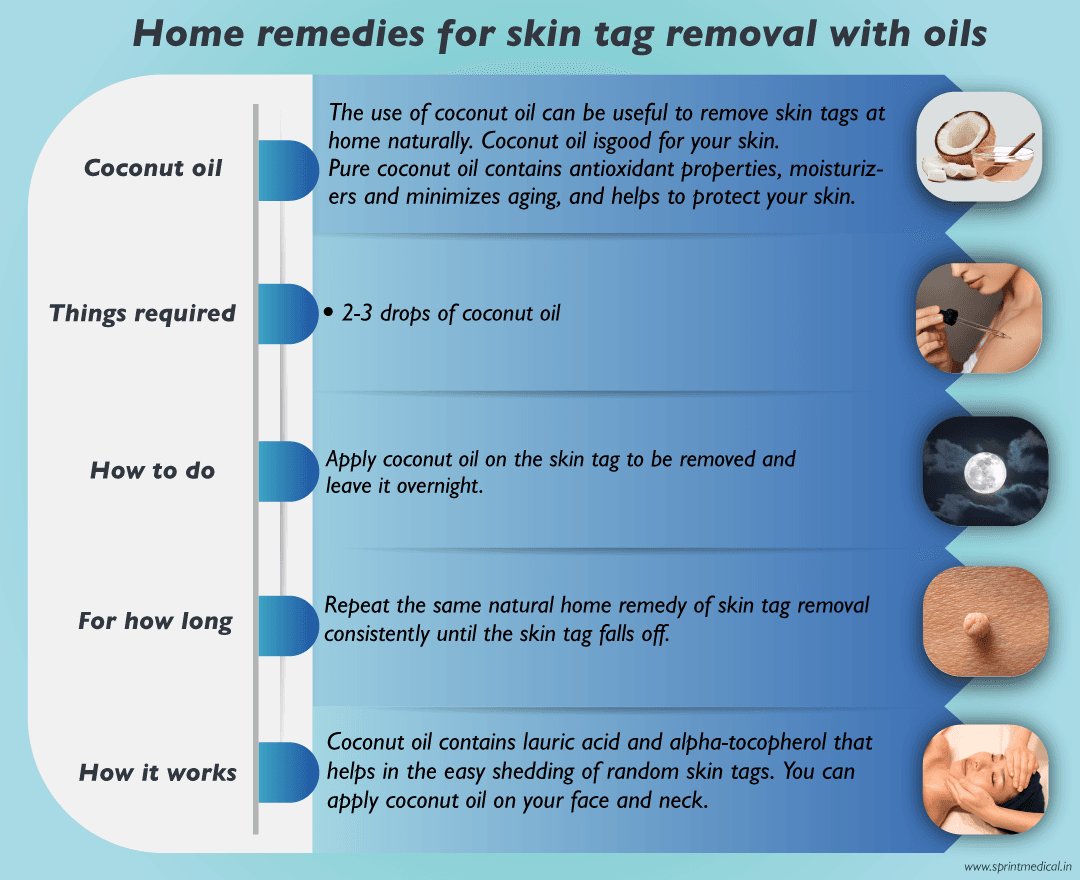 Home-remedies-for-skin-tag-with-coconut oil