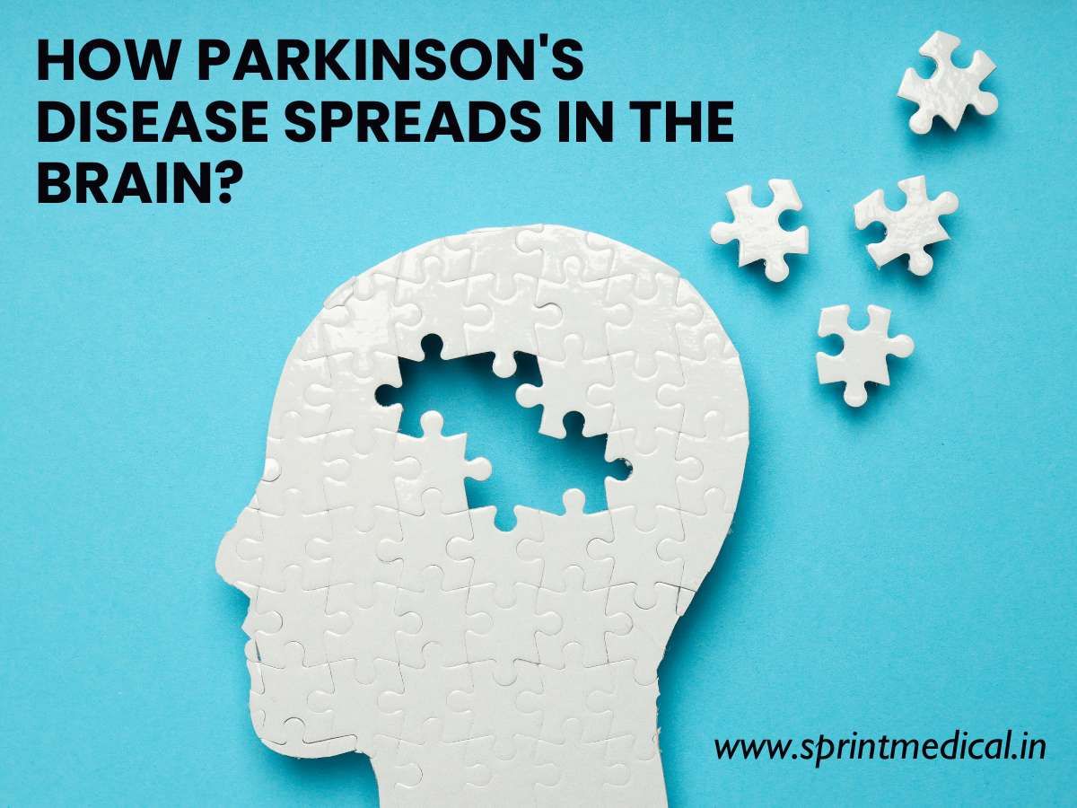 How-Parkinson-s-disease-spreads-in-the-Brain.jpg