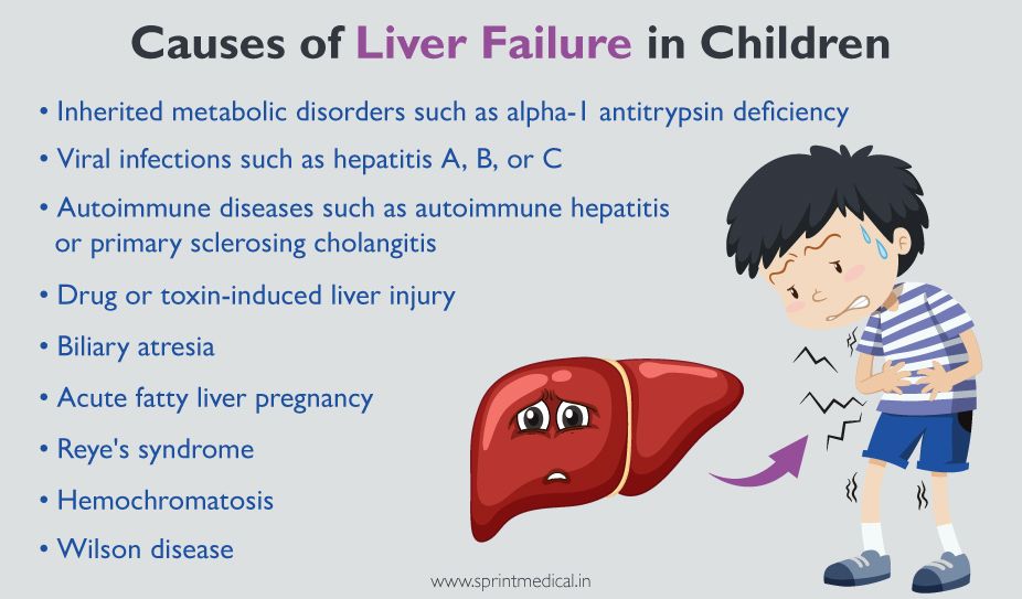 Liver Failure in Children