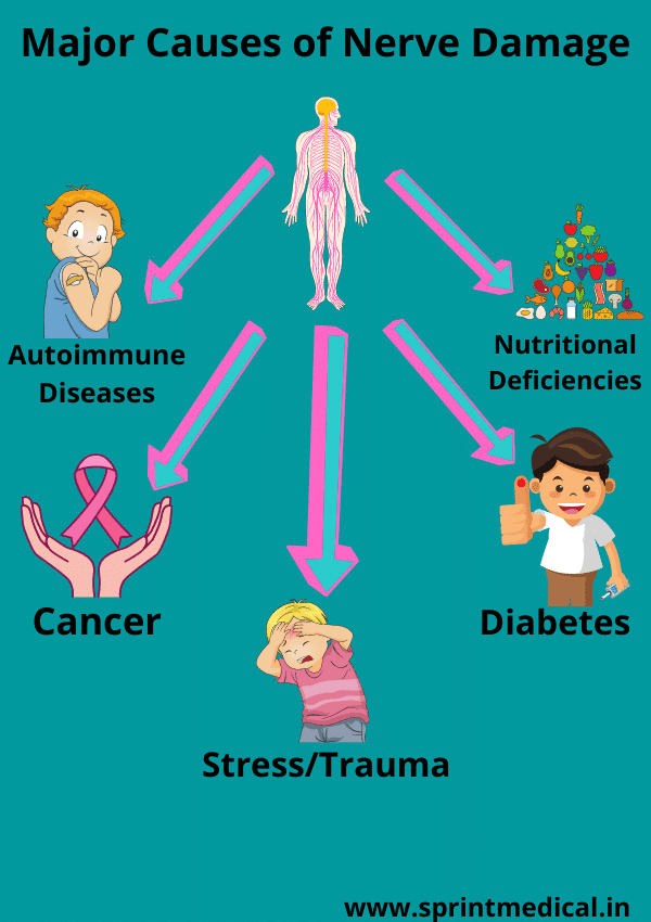 Major Causes of Nerve Damage