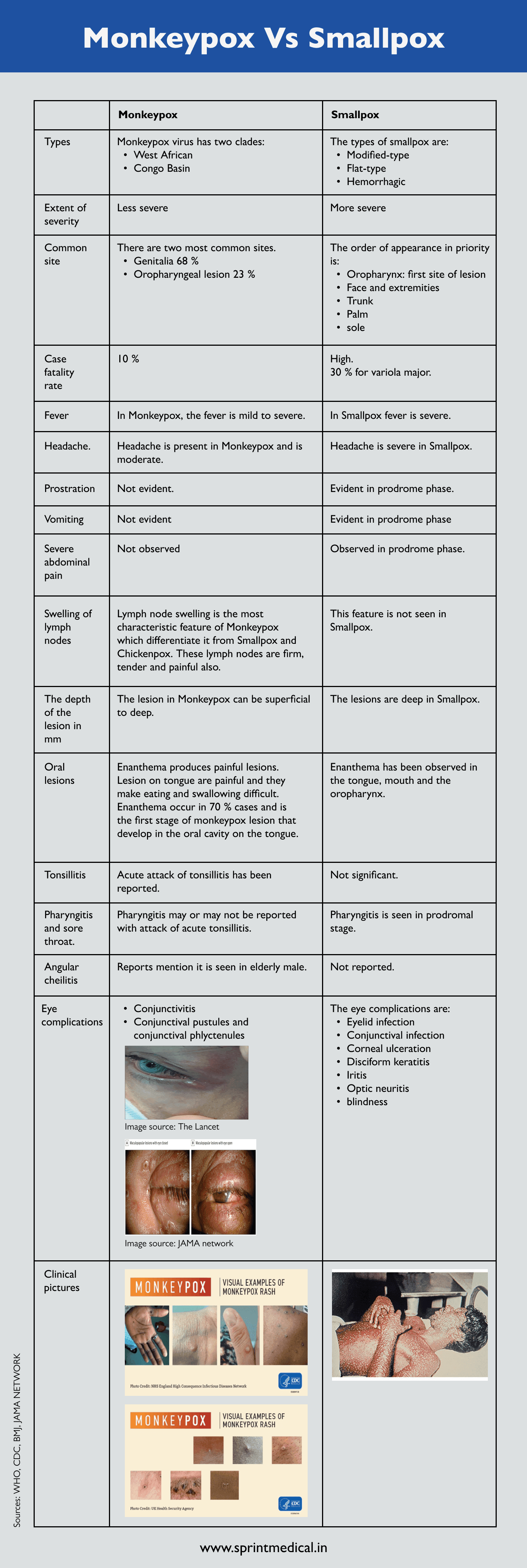 Monkeypox vs Smallpox