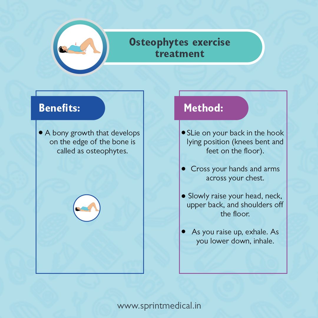 Osteophytes exercise treatment