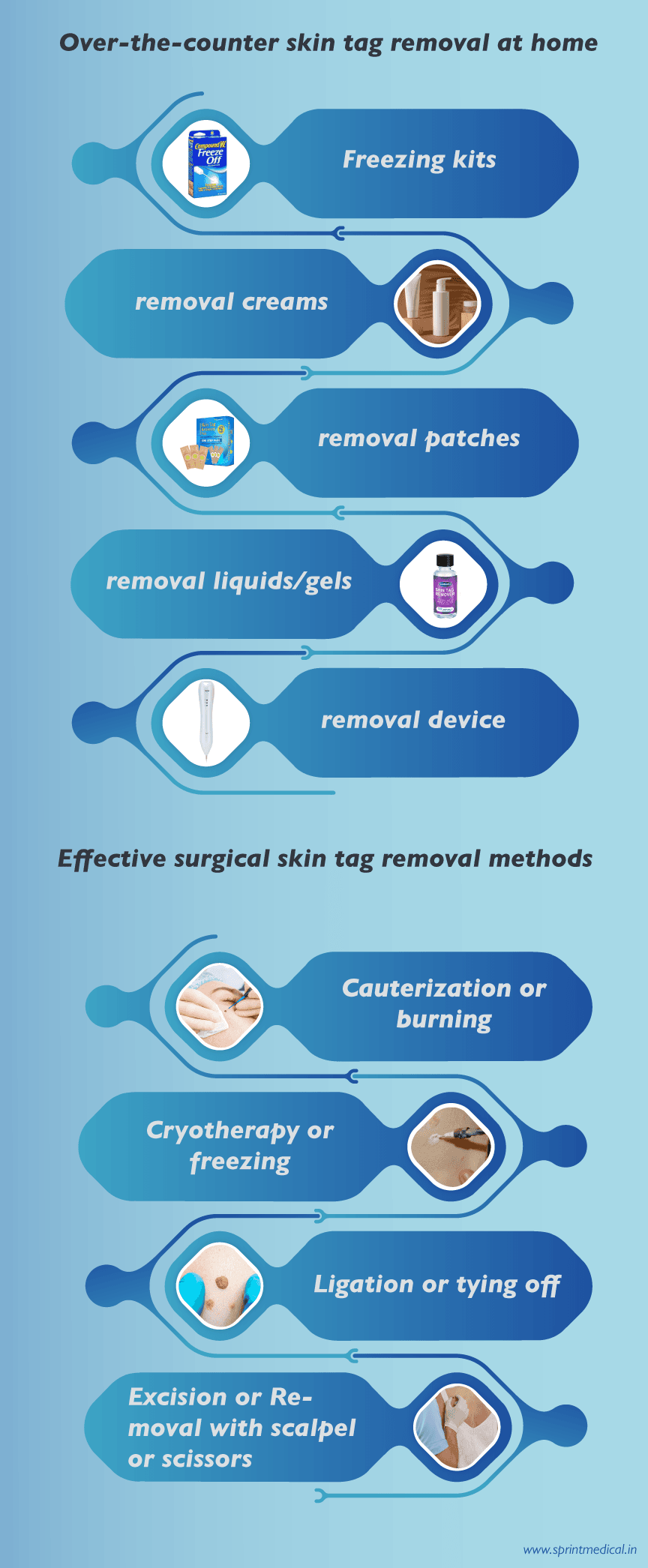 Over-the-counter-skin-tag-removal-at-home