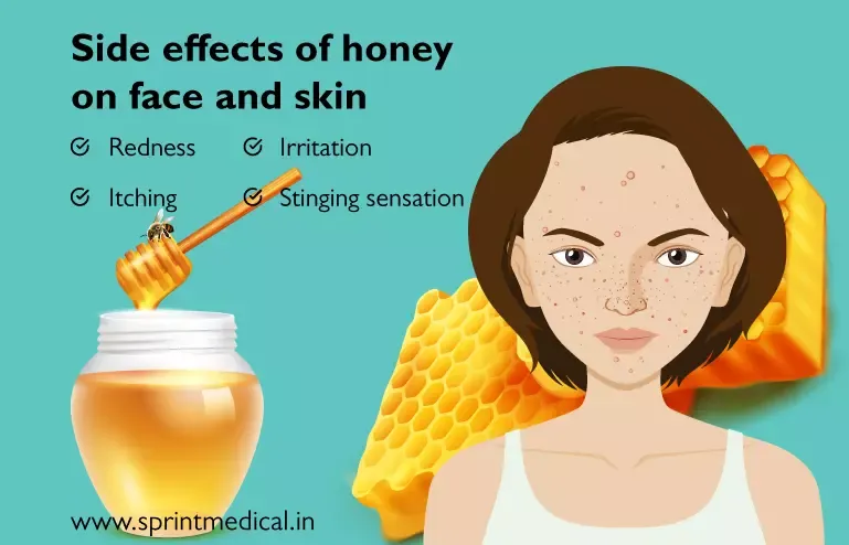 Side effects of honey on Face and Skin