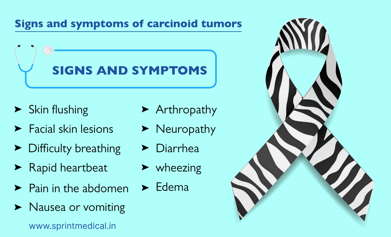 Signs and symptoms of carcinoid tumors
