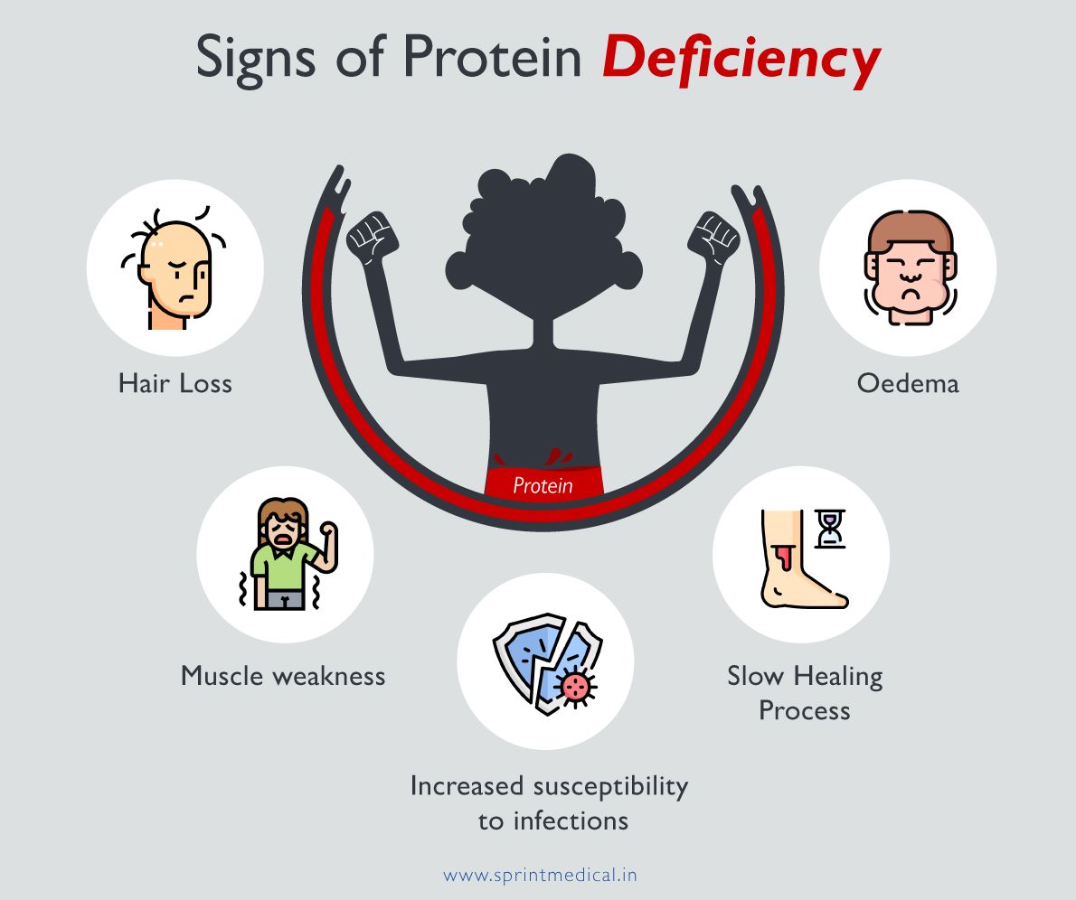 Signs of Protein Deficiency