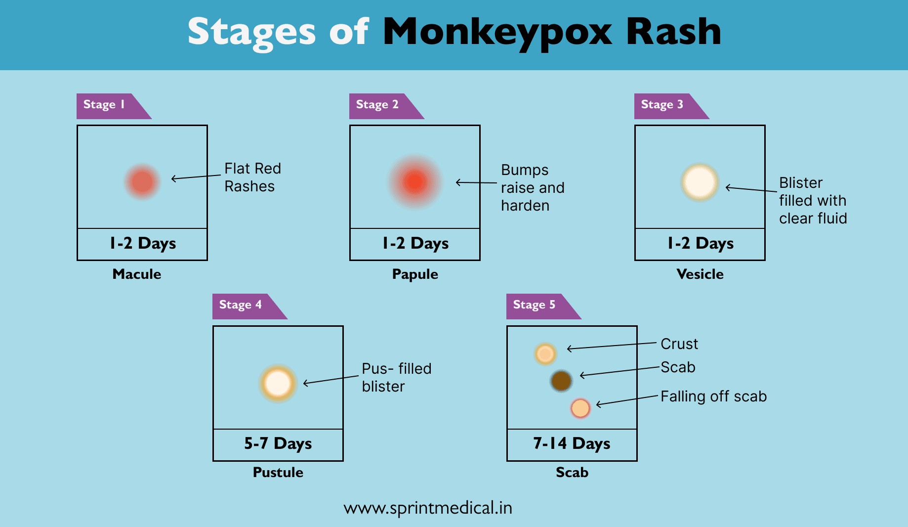 Stages of Monkeypox Rash
