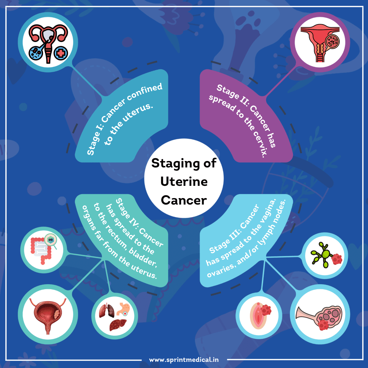 Staging of Uterine Cancer