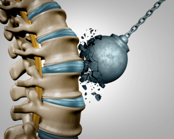 Olive Oil help strengthens bones