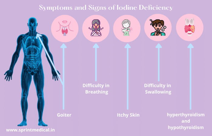 Symptoms and Signs of Iodine Deficiency