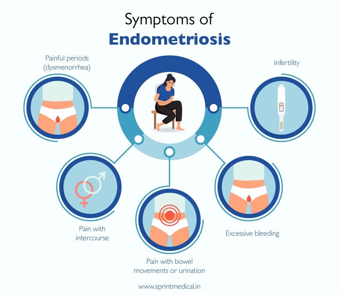 Symptoms of Endometriosis