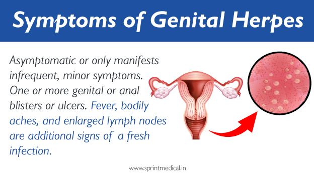 Symptoms of Genital herpes