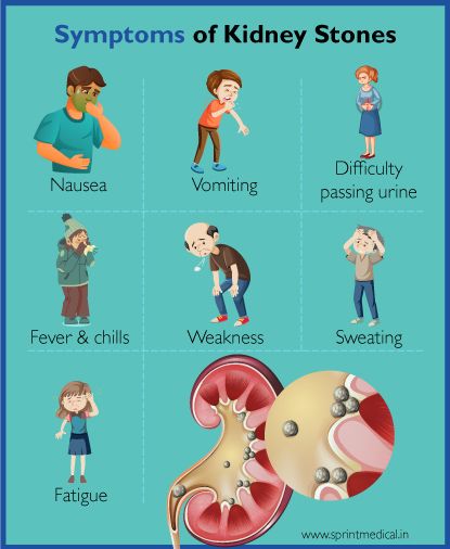 Symptoms of Kidney Stones