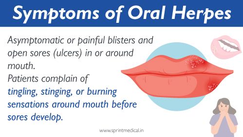 Symptoms of Oral herpes