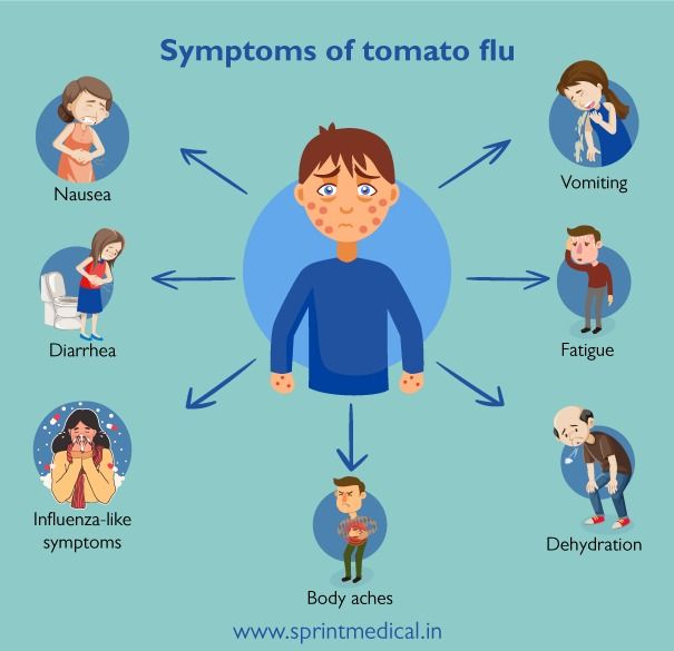 Symptoms of Tomato flu