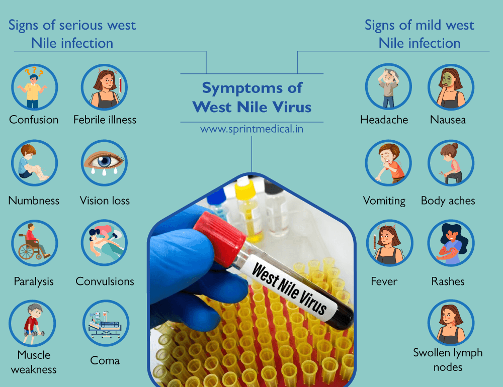 Symptoms of West Nile Virus