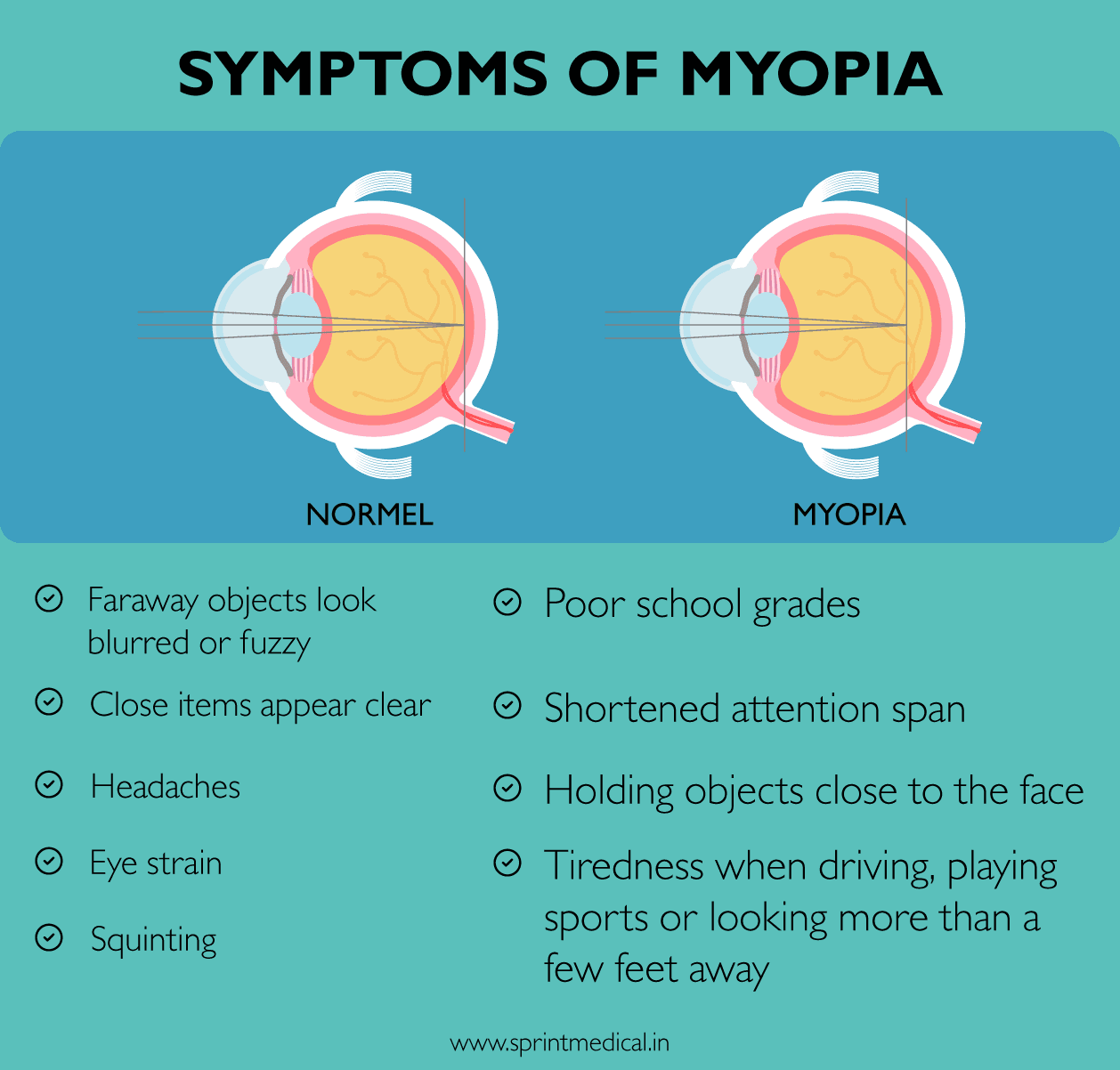 Symptoms of myopia