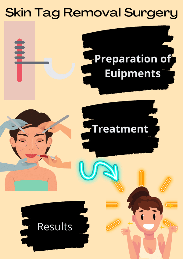Skin Tag Removal Surgery