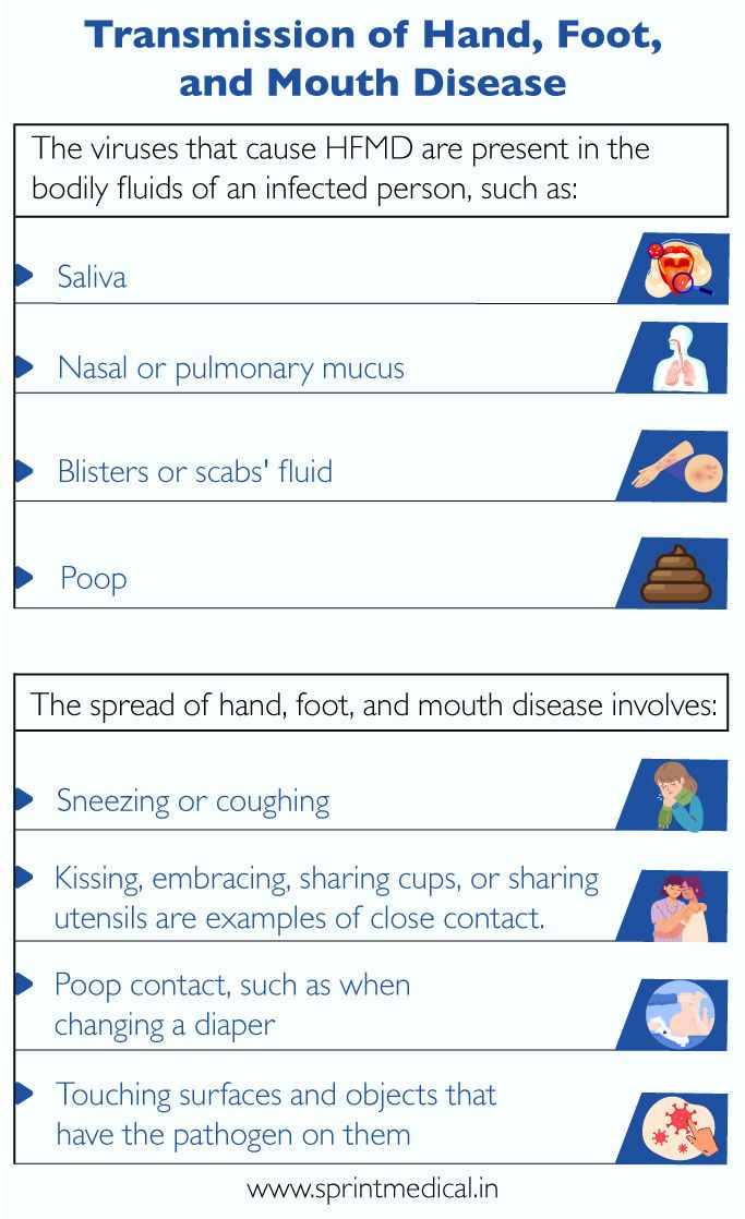 Transmission of Hand, Foot, and Mouth Disease