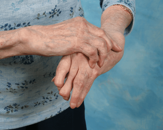 Treatment of Arthritis