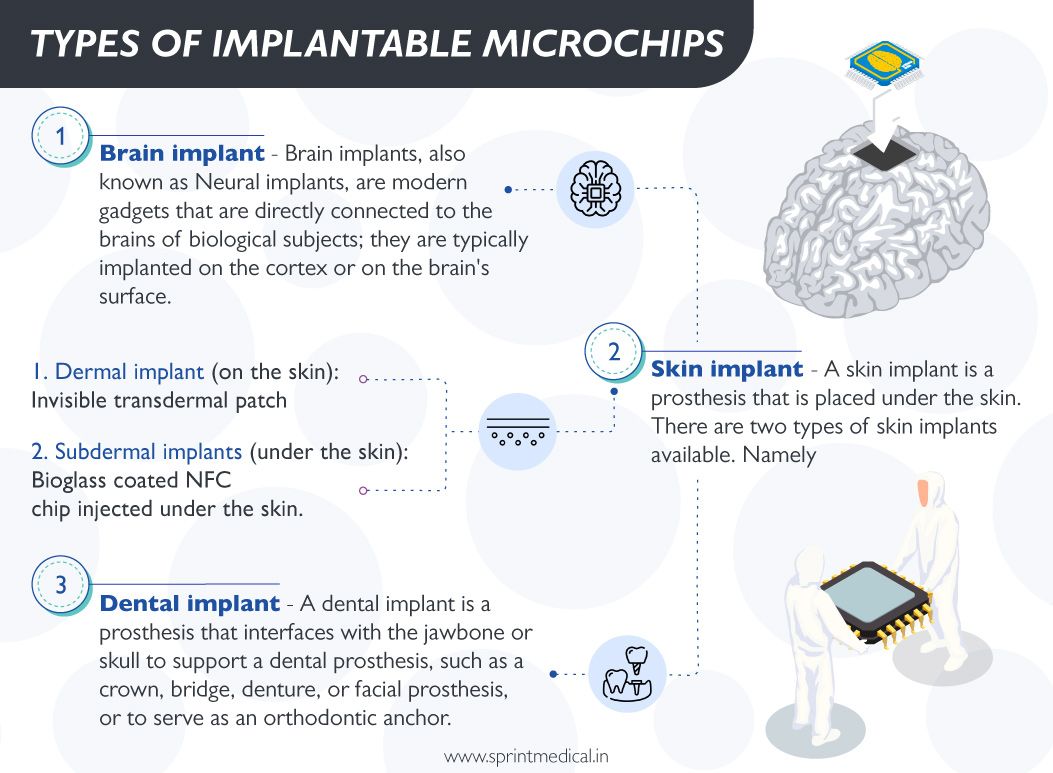 Types of Implantable Microchips