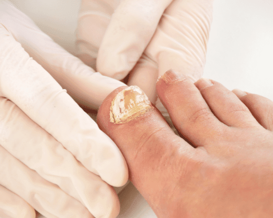 8 best ways to eat chia seeds