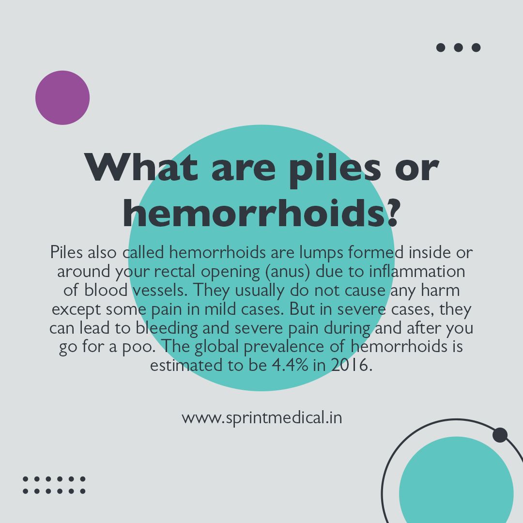 What are piles or hemorrhoids