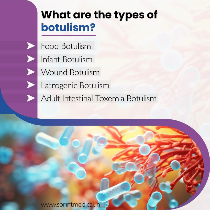 What are the types of botulism