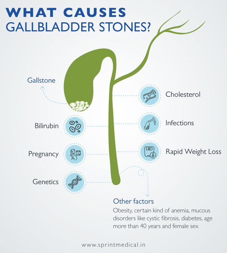 What causes gallbladder stones