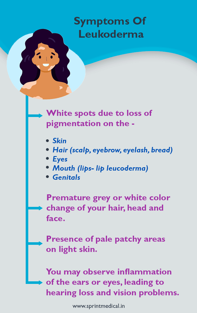 Symptoms of Leukoderma